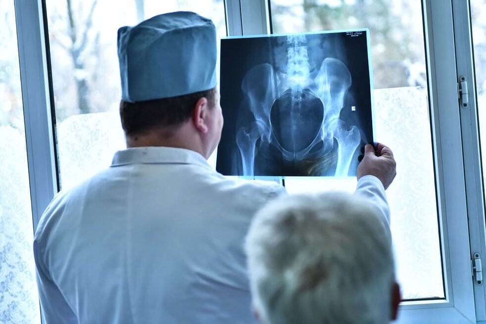Il medico esamina l'immagine di un'articolazione dell'anca con osteoartrosi